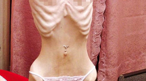 Anoressia, una cura potrebbe ridurre i sintomi. Si tratta della stimolazione magnetica transcranica