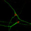 Università di Pisa: “Scoperto il segreto dell’evoluzione del cervello umano nei neuroni della dopamina”